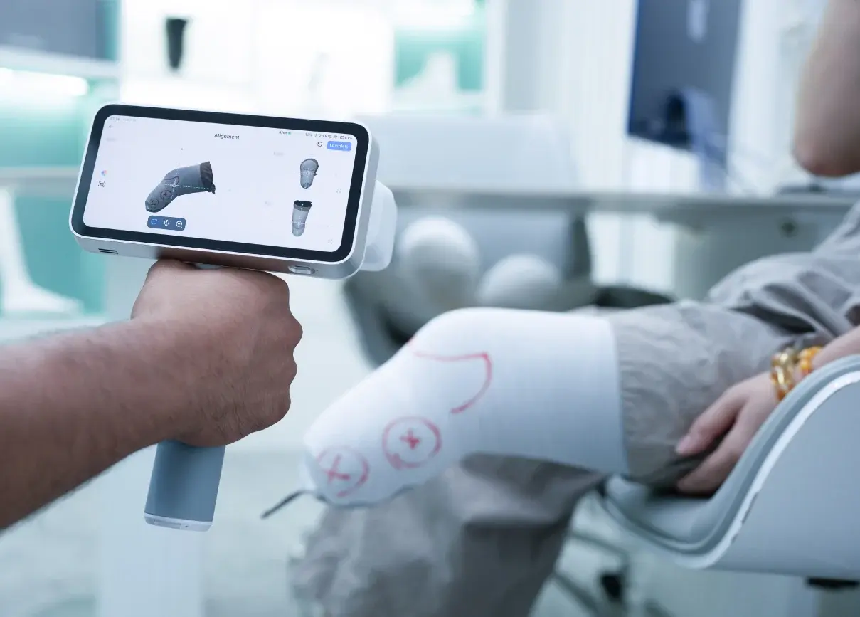A handheld scanner displaying a digital model of a residual-limb cast