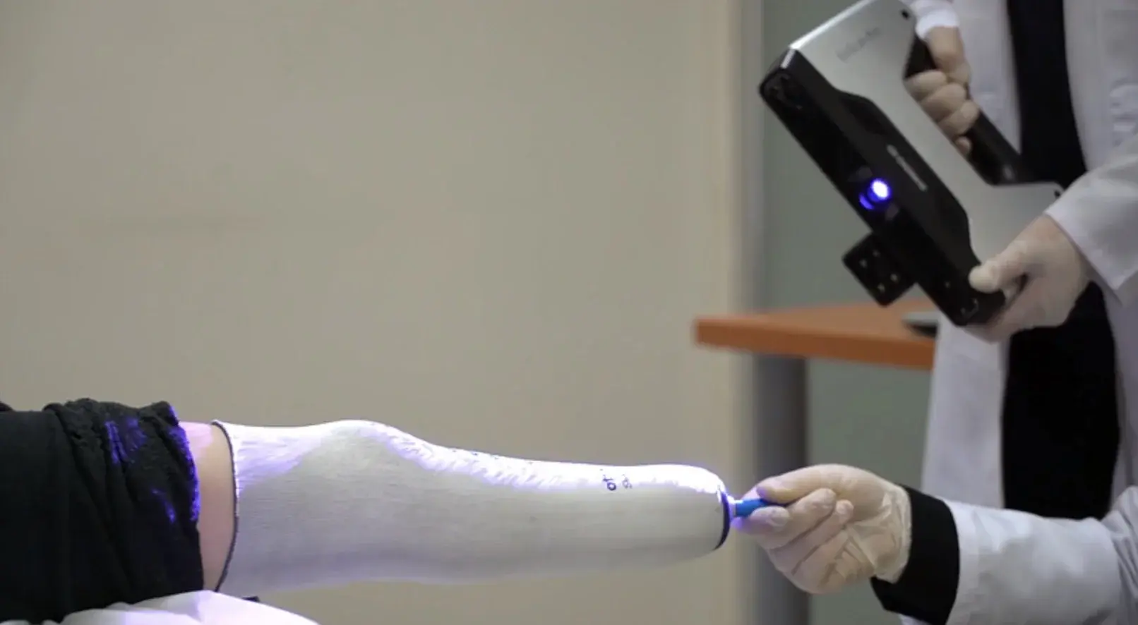 A residual limb being captured with a handheld 3D scanner
